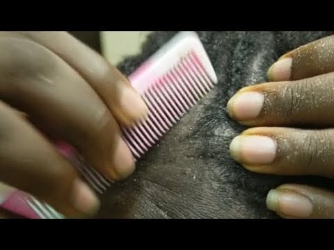 ASMR Attentive & Relaxing Scalp Scratching 😴