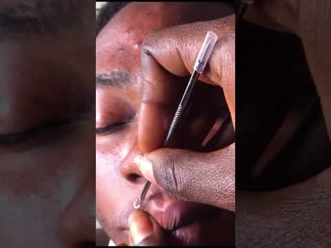 Asmr - A wonderful day To sleep Nitpicking #satisfying #asmr #whitehead