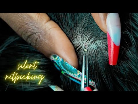 ASMR Specific NITPICKING Triggers for sleep 😴 | NO TALKING | with tweezers