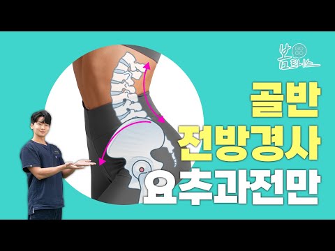 오리엉덩이, 똥배의 원인? 👉🏻 골반전방경사 / 요추과전만👈🏻 | 공간척추교정 | 도수치료