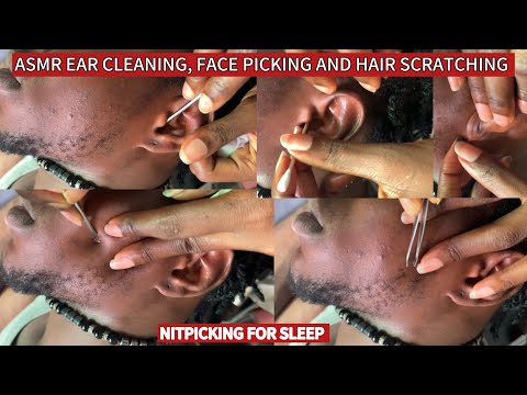 🦋 EAR🦋CLEANING ASMR, FACE NITPICKING, BEARDS SCRATCHING, HEAD SCRATCH FOR THOSE WHO NEED ATTENTION
