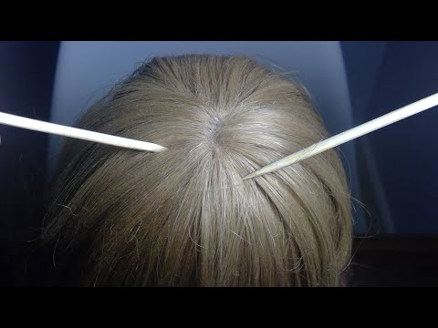 ASMR - Scalp Check and Treatment