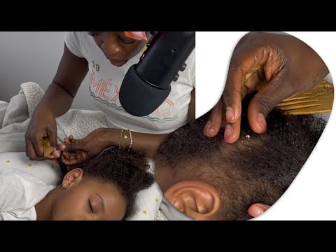 Very Upclose ATTENTIVE NITPICKING tiny whiteheads from her afro 