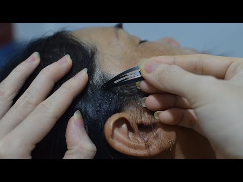 ASMR Scalp Scratching Dandruff, Scalp Check Itchy Treatment Relaxing For Sleep