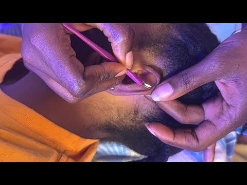 ASMR SATISFYING AND RELAXING EAR PICKING CLEANING, SCALP SCRATCHING WITH GUM CHEWING FOR YOUR SLEEP