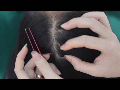 ASMR Scalp Scratching, Hair Parting With Tweezers, Hair Combing On Real Person For Headache Relief
