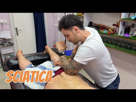 Treatment of sciatica back pain