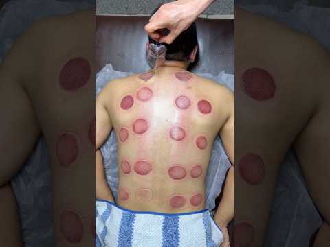 asmr vip cupping alinezhad#shorts #cupping #asmr #explore #viralshorts #asmrsounds #pizza #relax