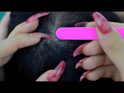 ASMR 15 Triggers Scalp Scratching, Scalp Check For Deep Sleep / Relaxing Sounds With Long Nails