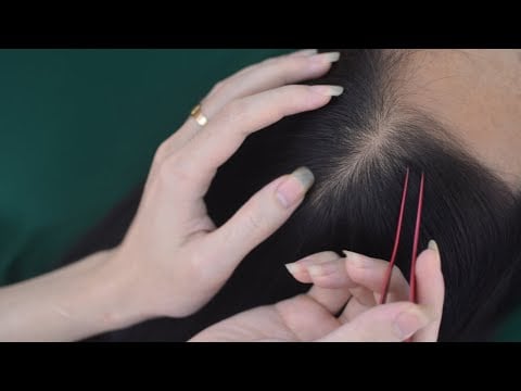 ASMR Tingly Scalp Massage, Scalp Scratching With Tweezers, Relaxing Sounds For Stress Relief