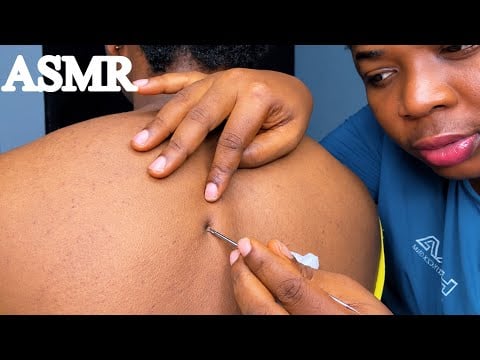 ASMR✨Back Nitpicking, Face Nitpicking & Deep Ear Cleaning for Relaxation and Sleep