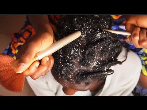 ASMR FAST AND AGGRESSIVE SCALP SCRATCHING WITH MULTIPLE TOOLS AND FAKE FLAKES REMOVAL😴😴