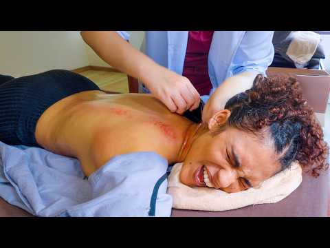 ASMR: INTENSE Chinese Back Guasha Massage with EYE Moxibustion and STEAM Therapy