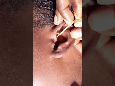 ASMR TINGLING EAR PICKING AND CLEANING #asmr #relax #earcleaning