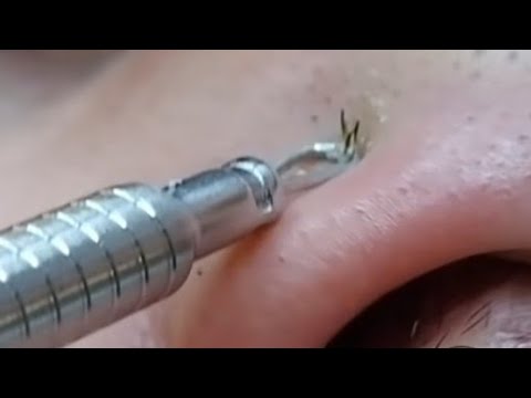ASMR TURKISH BARBER BY MUNUR ONKAN EXCELLENT MASSAGE , SKIN ANALYSIS ,TIGHTENING BLACKHEADS AND ACNE