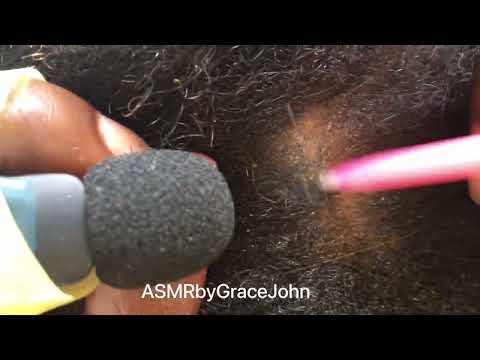 Asmr  A wonderful Day To Scratch #asmr #dandruff #anxietyrelief