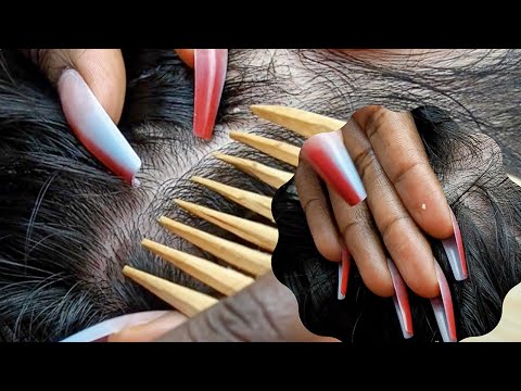 ASMR RARE Nitpicking | finger scratching for a Dreamy Night 🫠 running my fingers thru his hair.