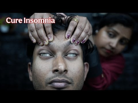 Fall Asleep Fast: ASMR Forehead Tapping for Insomnia Relief | Scratching Head Massage For Sleep