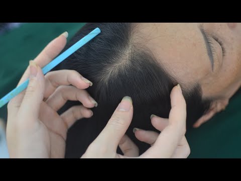 ASMR Scalp Scratch No Talking, Real Person Hair Brushing, Hair Combing For Stress Relief