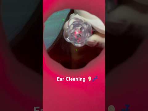 Limpeza de Ouvido ASMR em 1 Minuto 👂🕒 | Sons Relaxantes #asmrshorts #asmrroleplay #relaxing