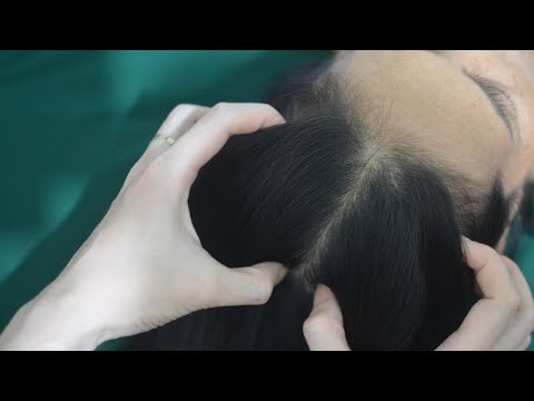 ASMR Intense Head Scratching, Scalp Scratch No Talking, Hair Tingling For Relaxation