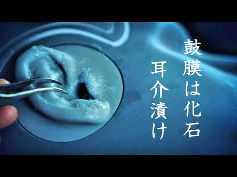 【ASMR SR3D 無言】ゴリゴリに化石化した鼓膜、シコリでガタガタ。乾燥した角質はパリパリ崩壊。耳介はネチネチ漬け。的な、シチュエーション耳掃除。貫通あり。with 秋の虫🦗