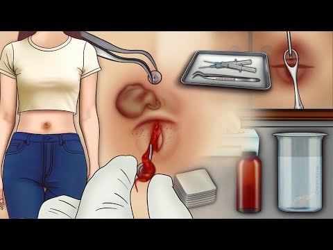 belly button\naval cleaning ASMR animation|| belly button piercing infection treatment animation||