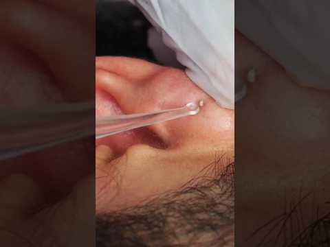 Tingly EAR PICKING & cleaning | FULL VIDEO ON OUR YOUTUBE CHANNEL #shortsvideo #shorts