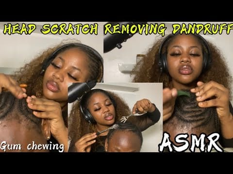 ASMR💫HEAD SCRACH  REMOVING DANDRUFF