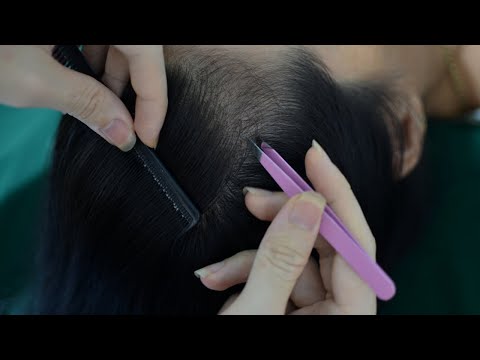 ASMR Scalp Check - Scalp Picking - Plucking White Hair For Relieve Stress, Anxiety ( No Talking )