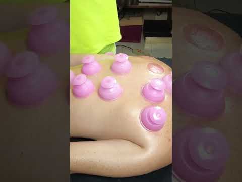 ASMR: Cupping Therapy and Back Massage | Deep Relaxation and Pain Relief