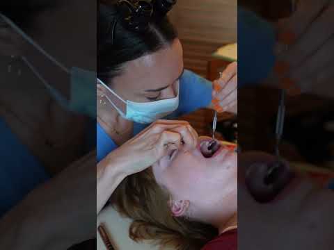 Asmr dental #asmr #asmrsounds #asmrvideo #relaxing #relax #satisfying #satisfyingvideo #tingles