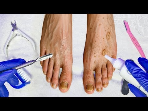Je m’occupe de tes pieds sales 🤢 (ASMR)