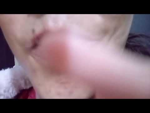Asmr m Gum chewing  mouthsounds sleep tingles