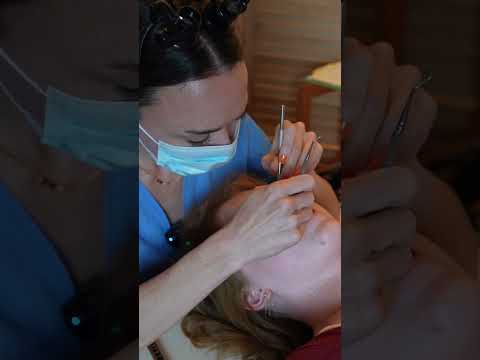 Asmr dental #asmr #asmrsounds #asmrvideo #relaxing #relax #satisfying #satisfyingvideo #tingles