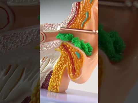Ear Cleaning ASMR #asmr #satisfying #asmrvideos