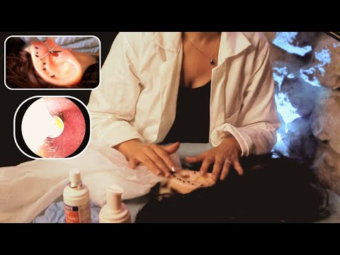 💤 Nettoyage interne et externe de l'oreille  (examen visuel avec caméra interne) - asmr orl