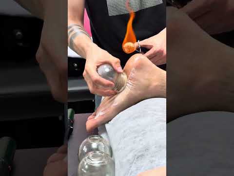 ASMR vip cupping alinezhad🔥#shorts #asmr #cuppingtherapy