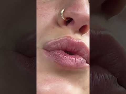 #kiss