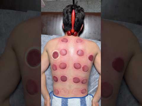 Pizza Cupping #shorts #pizza #cupping #asmr #relax #massage #explore #youtubeshorts