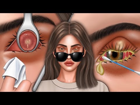 Relaxing Eye Infection Cleaning ASMR, Satisfying Eye Treatment ASMR Animation, ASMR Animation