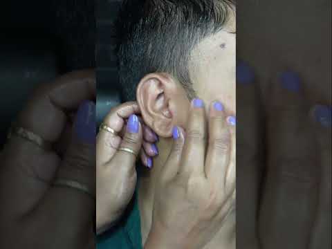 Chaitali's Calming Head & Ear Reflexology ASMR For Deep Sleep #shorts