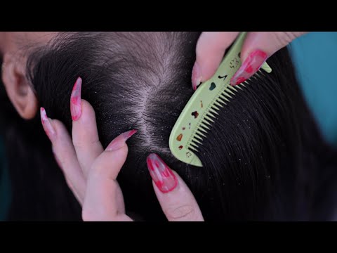 ASMR Real Person Scalp Check, Hair Parting & Hair Scratching Relaxing For Sleep ( No Talking )