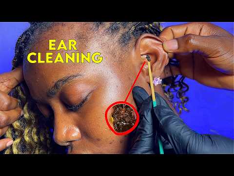 ASMR💫 Aggressive Head and EAR CLEANING MASSAGE / Deep Ear wax Removal Massage for Deep Sleep