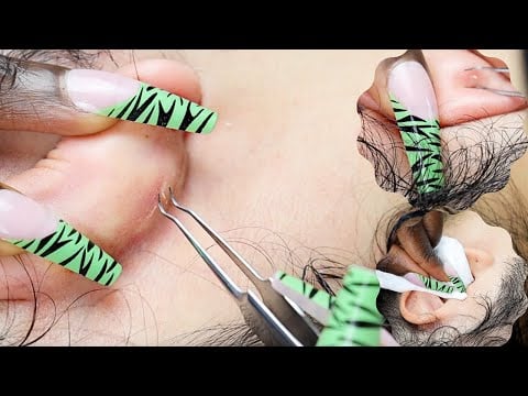 ASMR Deep & Attentive EAR cleaning ~ for sleep 😴 ~ wiping, rubbing, picking.