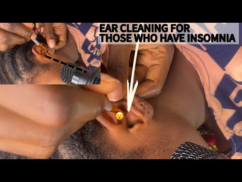 ASMR EAR CLEANING VERY SATISFYING FOR THOSE WHO NEED QUICK SLEEP WITH GUMCHEWING