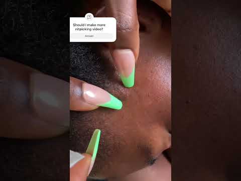 ASMR SUPER ATTENTIVE NITPICKING #facecleaning #asmrshorts