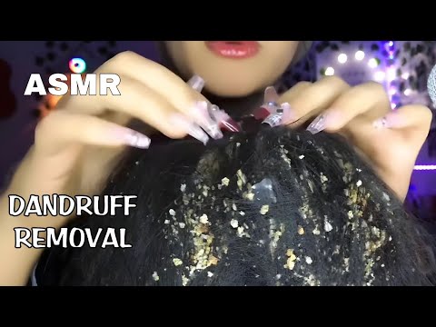 ASMR Dandruff Removal & Scalp Massage | Relaxing Hair Scratching (trying french) 💆🏻‍♀️💤