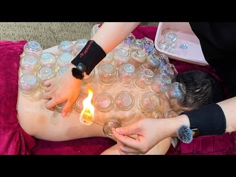 ASMR 🇻🇳 This Vietnamese Cupping Therapy Was Surprisingly Relaxing