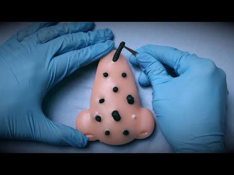 ASMR PARA RELAXAR REMOVENDO LARVAS DO SEU NARIZ - SWEET CAROL